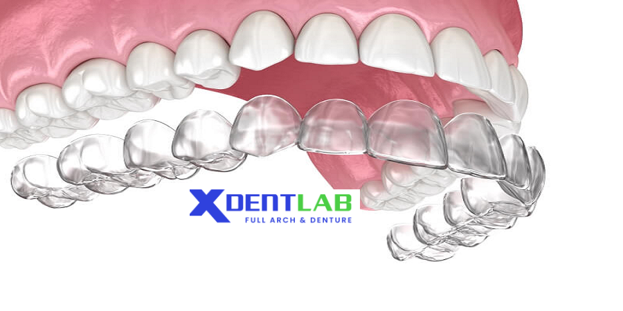 introduce Custom orthodontic clear aligners