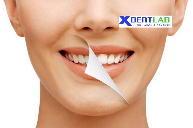 introduce Dental Lab in Vietnam