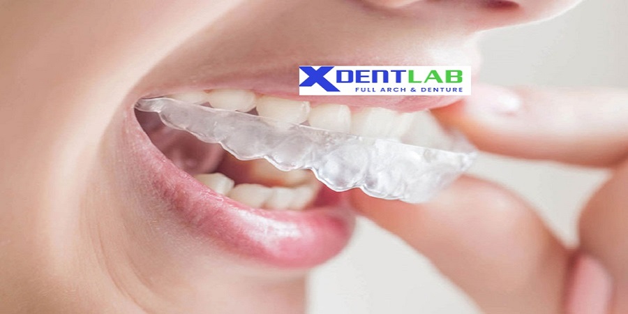 introduce Global clear aligner private label manufacturing