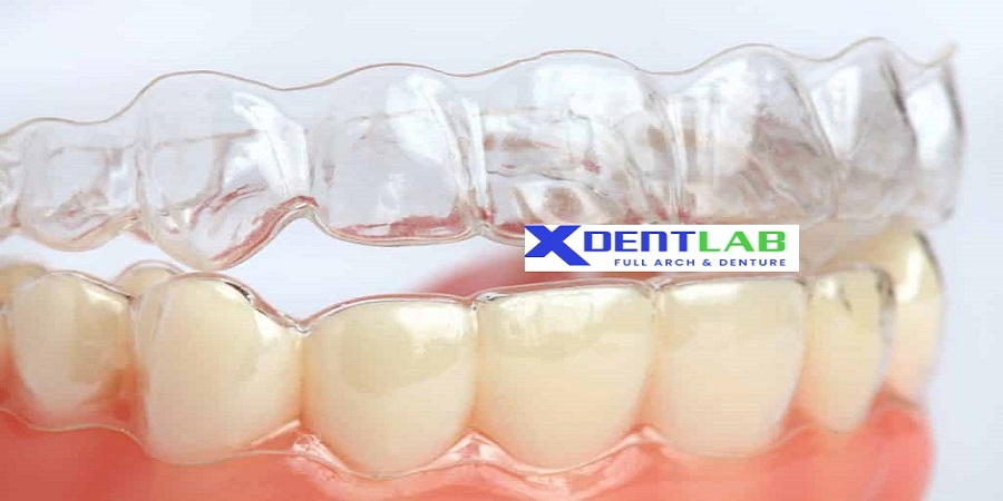 introduce Overseas clear aligner manufacturer