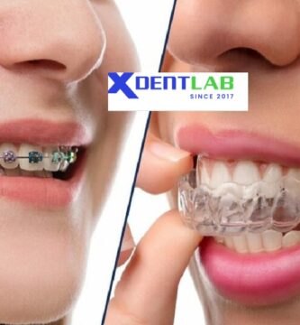 introduce Aligner Companies in Vietnam