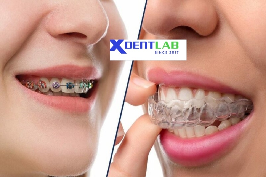 introduce Aligner Companies in Vietnam