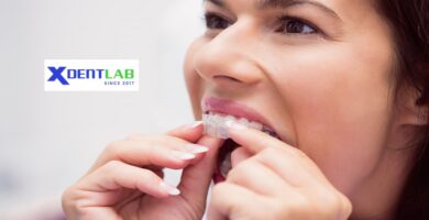 Clear Aligner Dental Labs