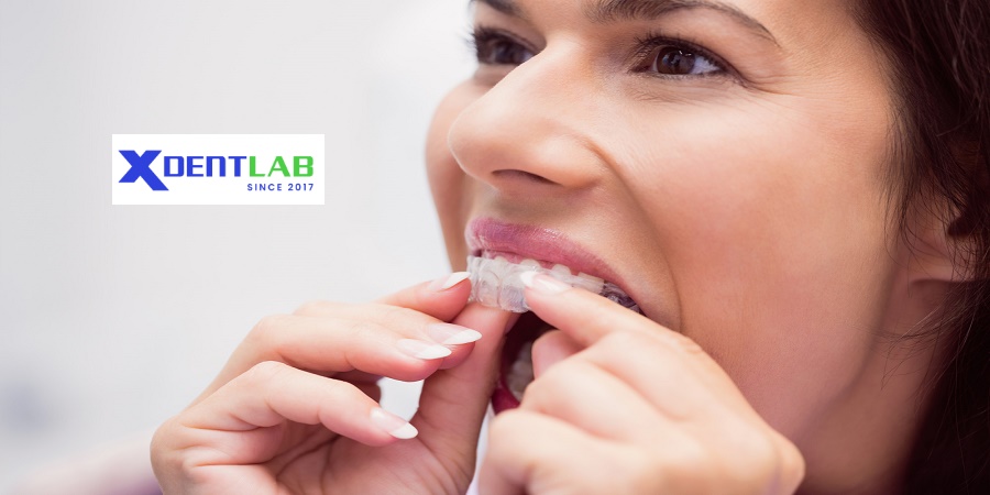 Clear Aligner Dental Labs