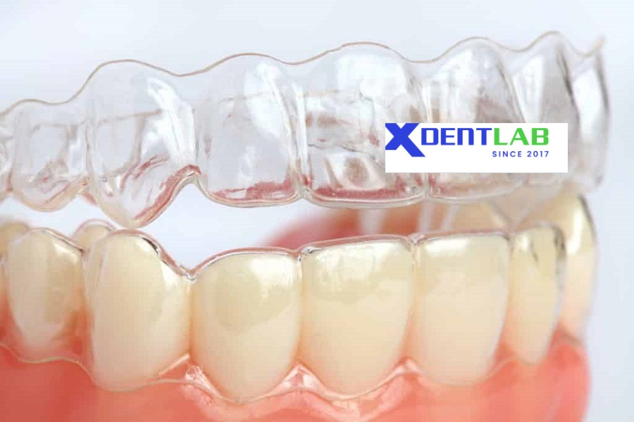 International Clear Aligner Suppliers