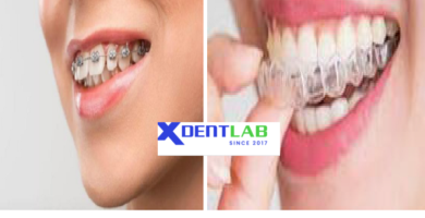 Introduce International orthodontic aligner production