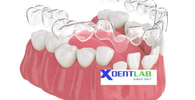 Outsource clear aligner production overseas