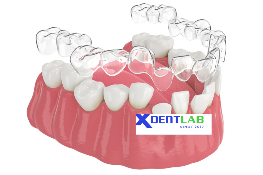 Outsource clear aligner production overseas