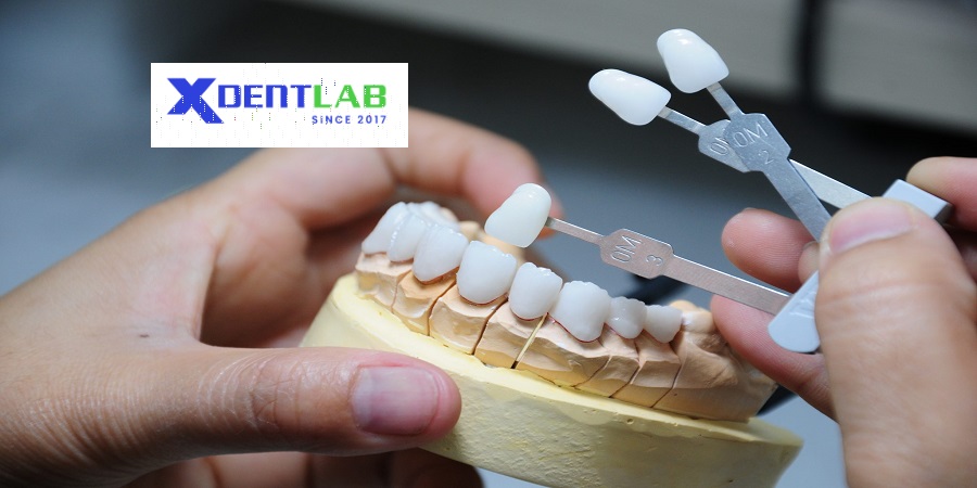 Vietnam dental laboratory district cu chi ho chi minh