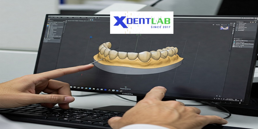 Exploring dental labs in vietnam
