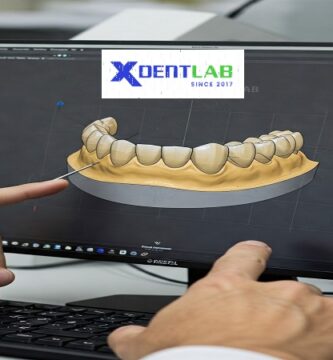 Introduction to the dental lab in vietnam