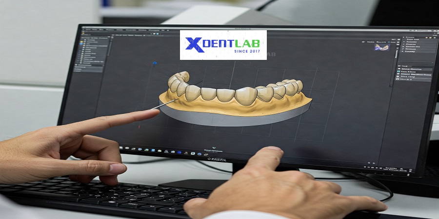 Introduction to the dental lab in vietnam