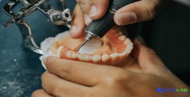 Removable Denture Lab District 7 Ho Chi Minh