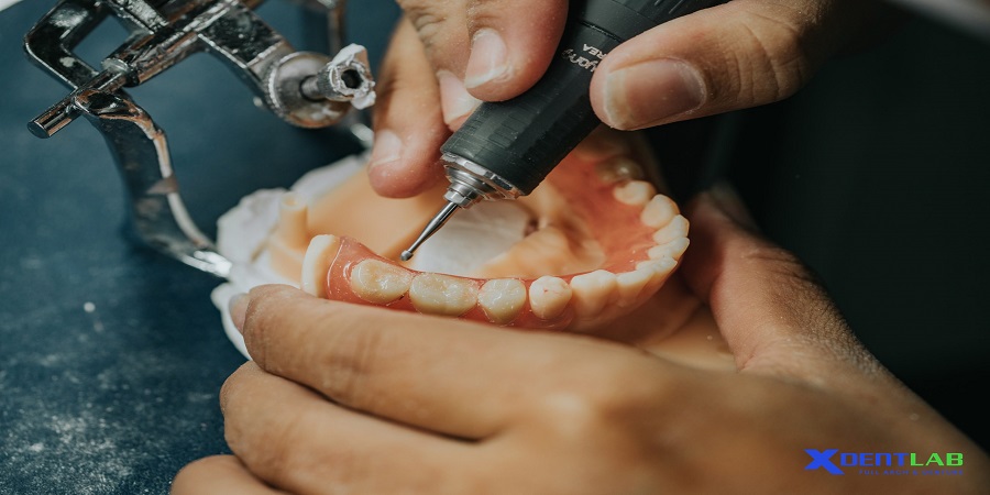 Removable Denture Lab District 7 Ho Chi Minh